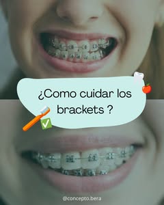 Concepto Bera - brackets